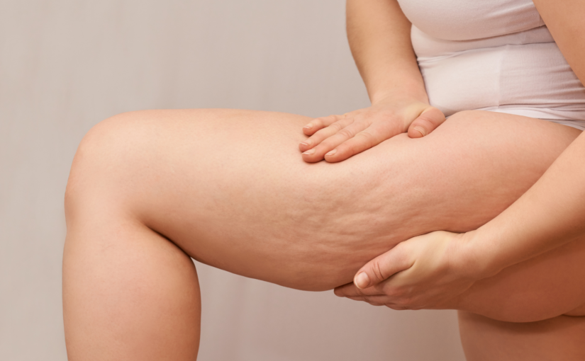Dites adieu à la cellulite avec la Ventouse Anti-Cellulite Électrique